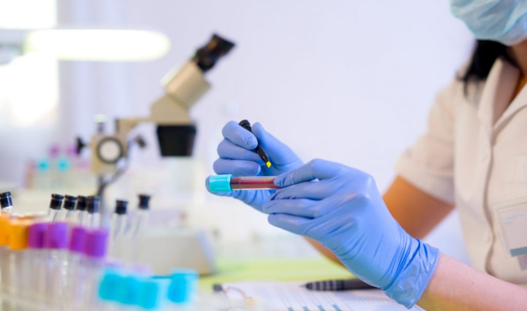 Why you should always wear gloves in the lab