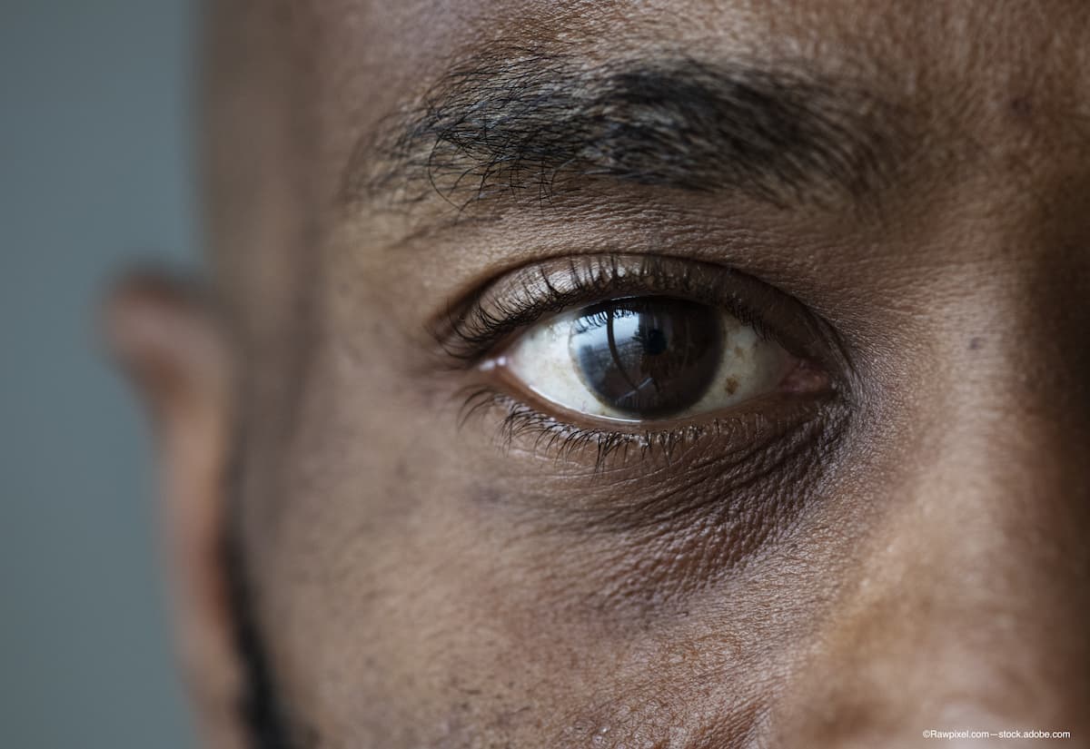 Why Evolve’s African eye health project matters